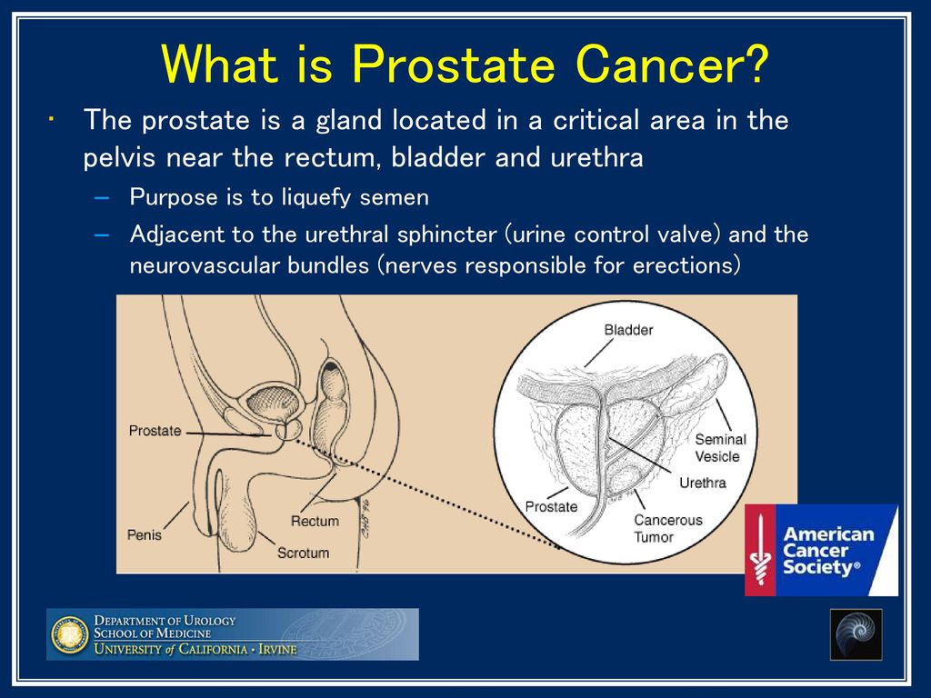 Where the prostate